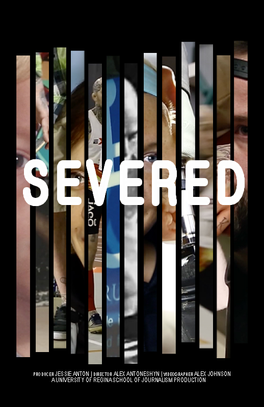SEVERED